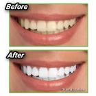 As Seen On Tv Miracle Teeth Whitener - Natural Charcoal Based Teeth Whitening